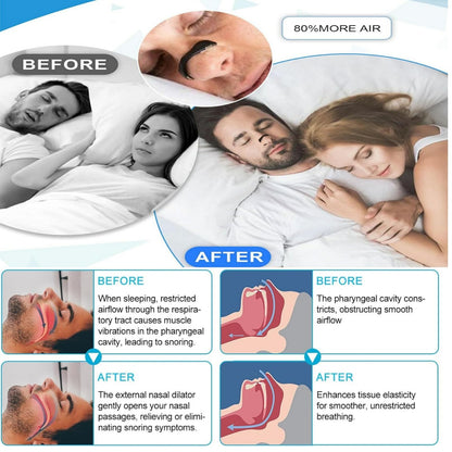Magnetic Nasal Strips - RRP: £12.99 - Anti-Snoring Device ? 60 Count